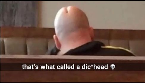 that's what called a dic*head